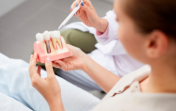 Implantes Dentários Saraiva Odontologia